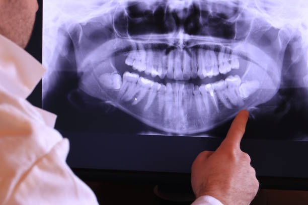Best Emergency Gum Pain Relief  in Leander, TX
